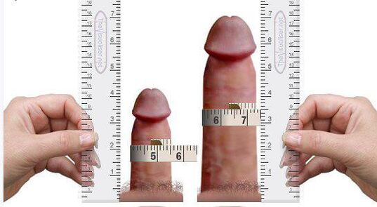 penis measurement for and after augmentation at home